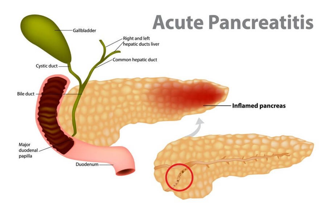 is-alcohol-inflammatory-these-are-the-risks-you-don-t-know-glycanage